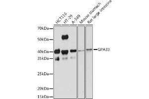 Western blot analysis of extracts of various cell lines, using GP Rabbit mAb (ABIN1682863, ABIN3017875, ABIN3017876 and ABIN7101532) at 1:1000 dilution.