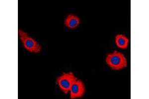 Immunofluorescent analysis of MUC16 staining in HuvEc cells. (MUC16 antibody  (Center))
