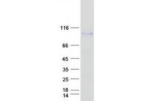 Validation with Western Blot (MASP1 Protein (Transcript Variant 2) (Myc-DYKDDDDK Tag))
