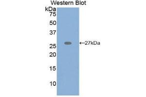 Western Blotting (WB) image for anti-Glutamate Receptor Interacting Protein 1 (GRIP1) (AA 874-1073) antibody (ABIN1859071) (GRIP1 antibody  (AA 874-1073))