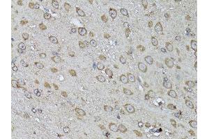Immunohistochemistry of paraffin-embedded mouse brain using SNAI1 antibody. (SNAIL antibody  (AA 1-264))