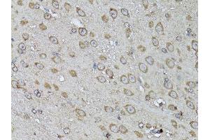 Immunohistochemistry of paraffin-embedded mouse brain using SNAI1 antibody. (SNAIL antibody  (AA 1-264))