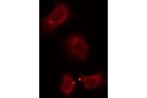 ABIN6276208 staining NIH-3T3 by IF/ICC. (OR7E5P antibody)