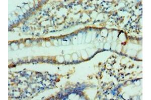 Immunohistochemistry of paraffin-embedded human small intestine tissue using ABIN7147898 at dilution of 1:100 (Claudin 2 antibody  (AA 30-230))