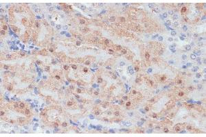 Immunohistochemistry of paraffin-embedded Mouse kidney using CLDN17 Polyclonal Antibody at dilution of 1:100 (40x lens).