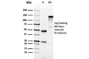 SDS-PAGE Analysis Purified NKX3. (NKX3-1 antibody  (AA 92-224))