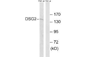Western blot analysis of extracts from HeLa cells, using DSG2 antibody. (Desmoglein 2 antibody)