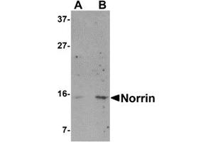 Western Blotting (WB) image for anti-Norrie Disease (Pseudoglioma) (NDP) (N-Term) antibody (ABIN1031487) (Norrie Disease (Pseudoglioma) antibody  (N-Term))