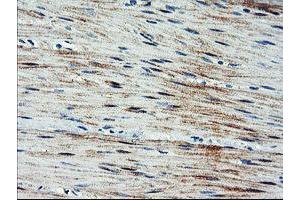 Immunohistochemical staining of paraffin-embedded Human colon tissue using anti-ARL11 mouse monoclonal antibody. (ARL11 antibody)