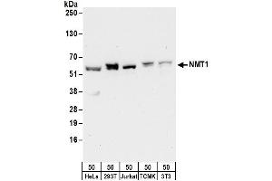 anti-N-Myristoyltransferase 1 (NMT1) (AA 50-100) antibody