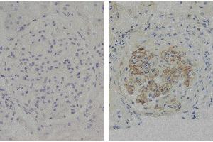 Paraffin embedded glomerular basement membrane tissue sections from patients with Anti-GBM disease were stained with Mouse Anti-Human IgG3 Hinge-UNLB (Mouse anti-Human IgG3 (Hinge Region) Antibody)