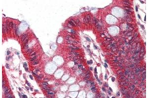 (ABIN190818) (2 μg/mL) staining of paraffin embedded Human Colon. (PLIN1 antibody  (Internal Region))