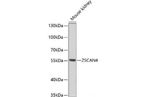Western blot analysis of extracts of Mouse kidney using ZSCAN4C Polyclonal Antibody at dilution of 1:1000. (ZSCAN4C antibody)
