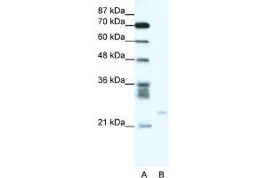 WB Suggested Anti-BCL2A1 Antibody Titration:  0. (BCL2A1 antibody  (C-Term))