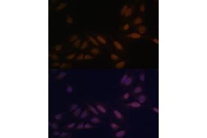 Immunofluorescence analysis of U-2 OS cells using EED Polyclonal Antibody (ABIN6133691, ABIN6139940, ABIN6139943 and ABIN6216521) at dilution of 1:100 (40x lens). (EED antibody  (AA 1-100))