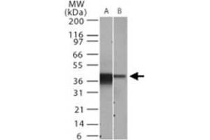 Western blot analysis of NFKBIA. (NFKBIA antibody  (AA 32-291))