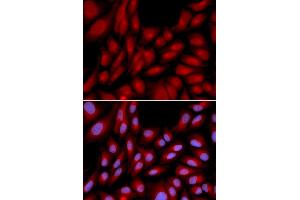 Immunofluorescence analysis of U2OS cells using BAG1 antibody (ABIN5970457). (BAG1 antibody)