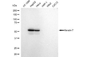 Western blotting analysis using Keratin 7 antibody (ABIN7799186).