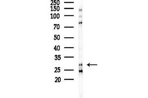 anti-Mitochondrial Ribosomal Protein L10 (MRPL10) (C-Term) antibody