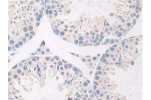 Detection of GnRH in Mouse Testis Tissue using Polyclonal Antibody to Gonadotropin Releasing Hormone (GnRH) (GNRH1 antibody  (AA 22-90))