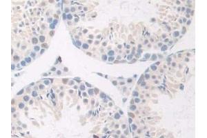 Detection of GnRH in Mouse Testis Tissue using Polyclonal Antibody to Gonadotropin Releasing Hormone (GnRH)