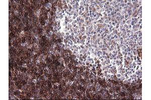 Immunohistochemistry (IHC) image for anti-T-cell surface glycoprotein CD1c (CD1C) antibody (ABIN2670659) (CD1c antibody)