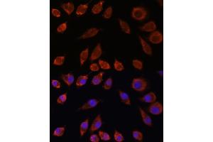 Immunofluorescence analysis of L929 cells using HPS4 antibody (ABIN7267623) at dilution of 1:100. (HPS4 antibody  (AA 550-650))