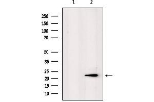 Western blot analysis of extracts from mouse lung, using PPP1R2P3 Antibody. (PPP1R2P3 antibody)