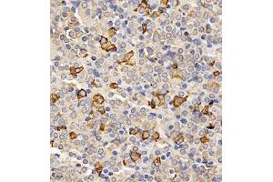 Immunohistochemistry (Paraffin-embedded Sections) (IHC (p)) image for anti-Thyroid Stimulating Hormone, beta (TSHB) antibody (ABIN7075906)