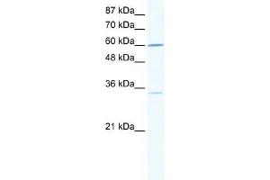 Human Jurkat; WB Suggested Anti-ZNF668 Antibody Titration: 0. (ZNF668 antibody  (N-Term))