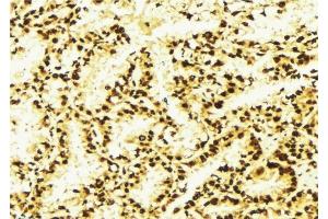 ABIN6276976 at 1/100 staining Human lung tissue by IHC-P. (PSMD10 antibody  (C-Term))