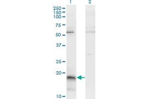 Western Blot analysis of PAEP expression in transfected 293T cell line by PAEP monoclonal antibody (M01), clone 6G2. (PAEP antibody  (AA 53-162))