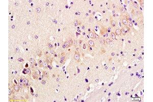Formalin-fixed and paraffin embedded: rat brain tissue labeled with Anti-GAP-43 Polyclonal Antibody, Unconjugated  at 1:300 followed by conjugation to the secondary antibody and DAB staining