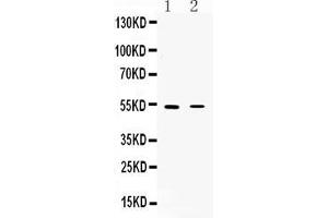 CHRNA5 antibody  (N-Term)