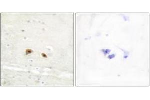Immunohistochemistry analysis of paraffin-embedded human brain tissue, using EGR3 Antibody. (EGR3 antibody  (AA 338-387))
