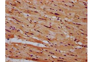 IHC image of ABIN7149034 diluted at 1:600 and staining in paraffin-embedded human heart tissue performed on a Leica BondTM system. (CSAD antibody  (AA 344-493))