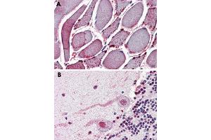 Immunohistochemical staining of formalin-fixed, paraffin-embedded human skeletal muscle (A) and human brain (B), cerebellum tissue after heat-induced antigen retrieval.