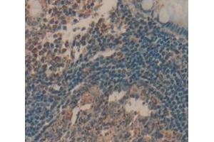 Figure. (LAT antibody  (AA 25-221))