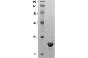 Validation with Western Blot (eIF4EBP1 Protein (His tag))