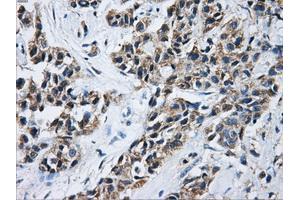 Immunohistochemical staining of paraffin-embedded Kidney tissue using anti-ACO2mouse monoclonal antibody. (ACO2 antibody)