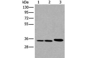 Western blot analysis of A549 Hela and K562 cell lysates using RPF2 Polyclonal Antibody at dilution of 1:400