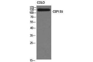Western Blotting (WB) image for anti-Centrosomal Protein 135kDa (CEP135) (C-Term) antibody (ABIN3183857) (CEP135 antibody  (C-Term))