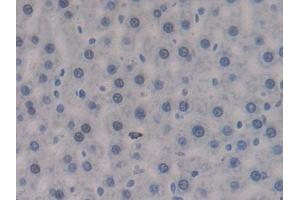 DAB staining on IHC-P; Samples: Rat Liver Tissue (PTPRJ antibody  (AA 1033-1277))
