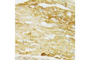 Immunohistochemistry of paraffin-embedded mouse heart using HSPA9 antibody.