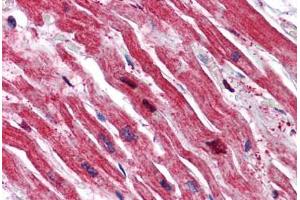 Human Heart: Formalin-Fixed, Paraffin-Embedded (FFPE) (SRPX antibody  (N-Term))