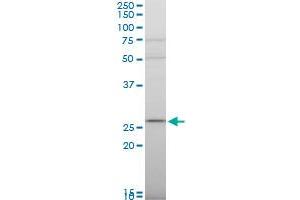 RPS9 polyclonal antibody (A01), Lot # 051207JC01. (RPS9 antibody  (AA 105-194))