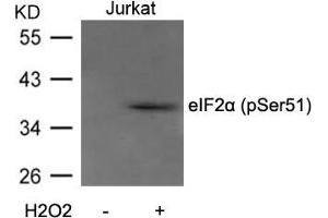 Western blot analysis of extracts from Jurkat cells untreated or treated with H2O2 using eIF2a(Phospho-Ser51) Antibody. (EIF2S1 antibody  (pSer51))