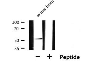 CXCR7 antibody  (Internal Region)