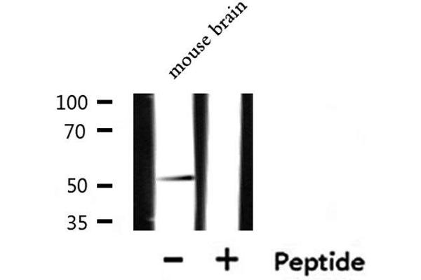 CXCR7 antibody  (Internal Region)