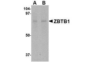 Image no. 1 for anti-Zinc Finger and BTB Domain Containing 1 (ZBTB1) (Internal Region) antibody (ABIN341710) (ZBTB1 antibody  (Internal Region))
